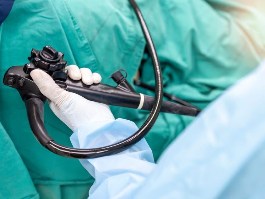endoscopy